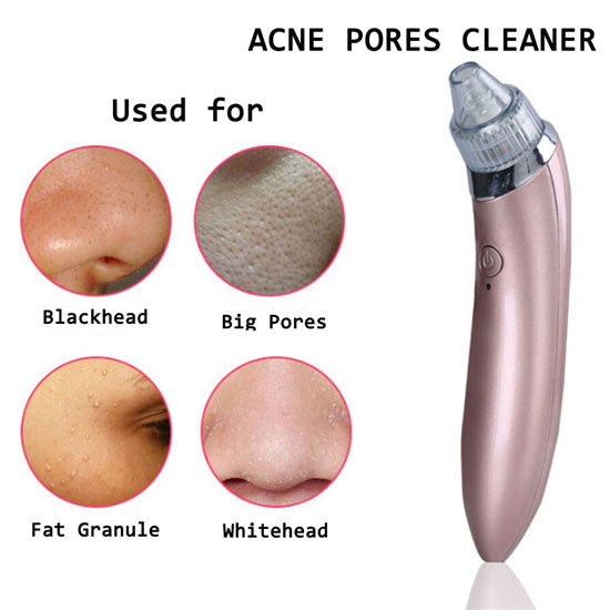 Rechargeable Blackhead Removal Machine